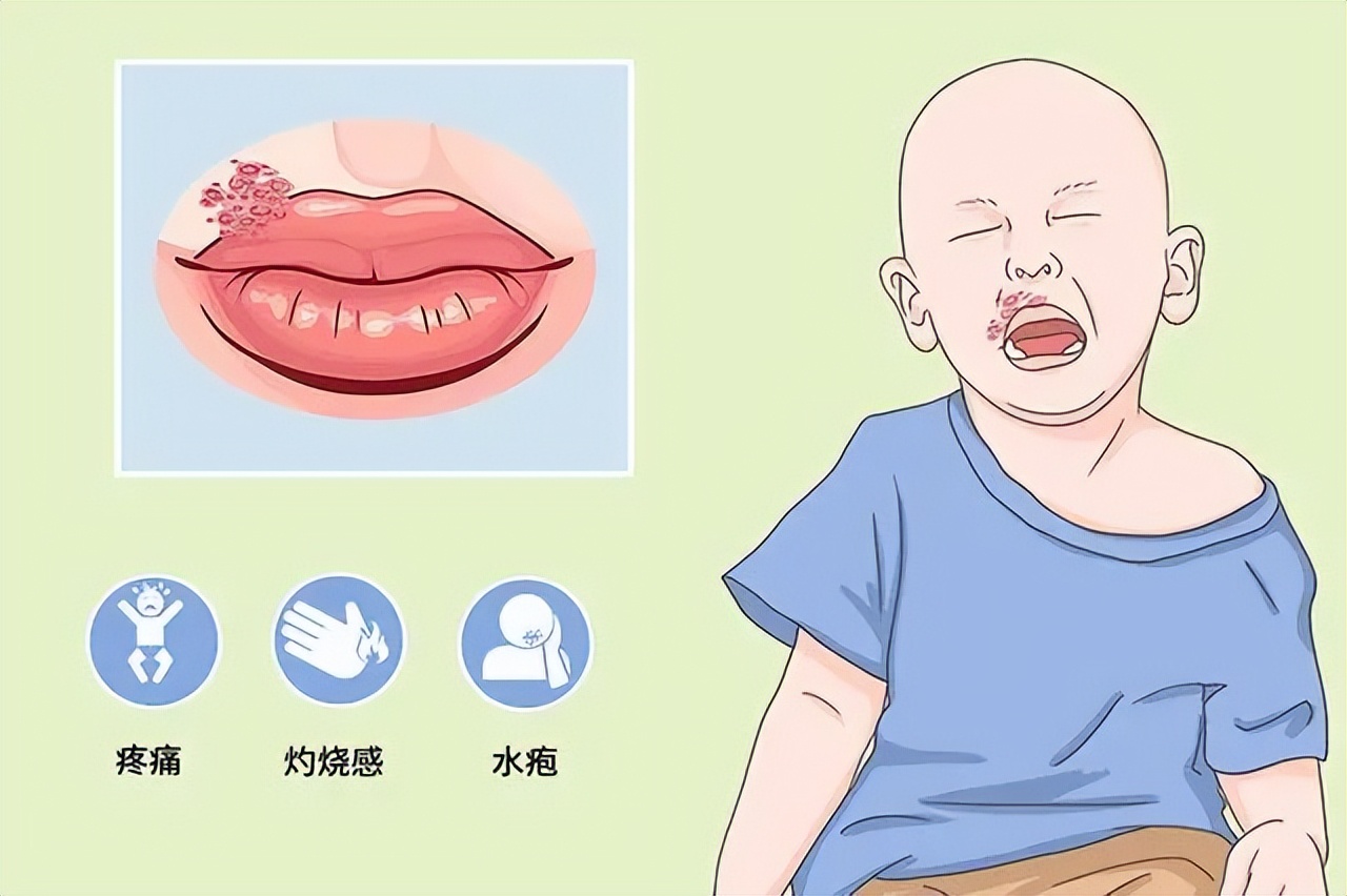 嘴巴周围有好多小水泡是上火吗,嘴上上火长水泡会传染吗