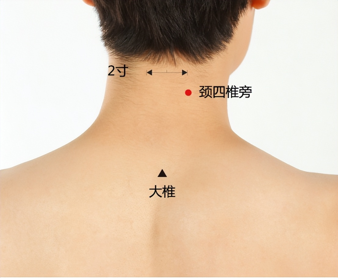 颈部以上爱出汗是什么阳虚,头发颈部老出汗是怎么回事