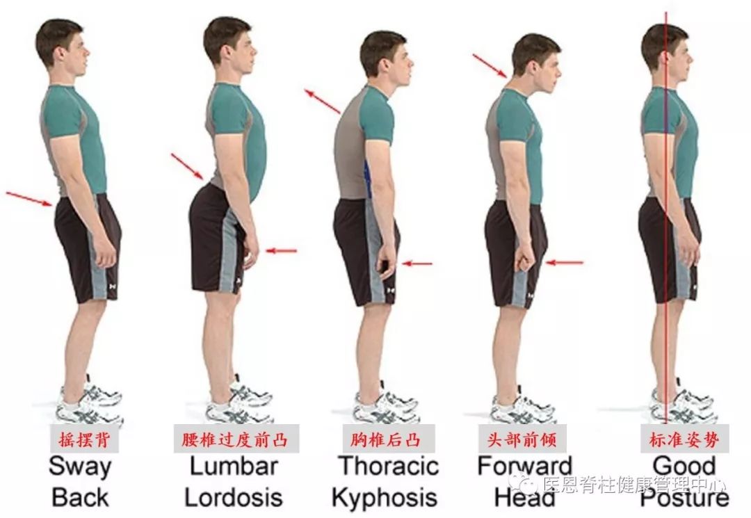 腰椎生理前凸消失是什么意思,颈椎间盘向后局限性突出