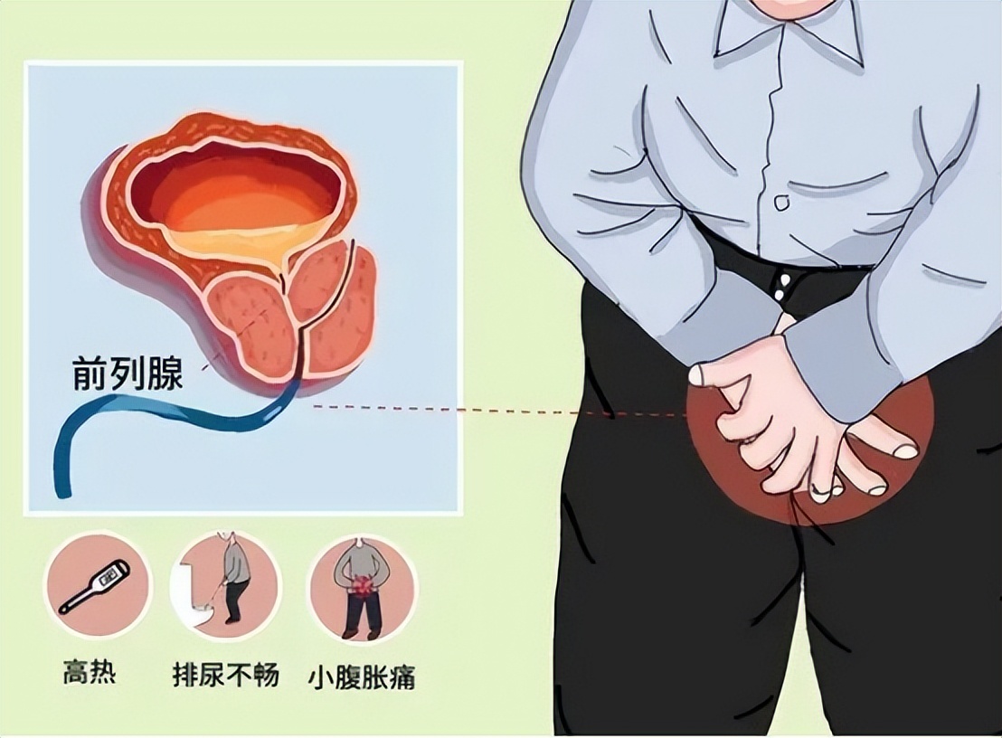 36岁的男性前列腺炎发病率有多高,前列腺炎病因及发病机制