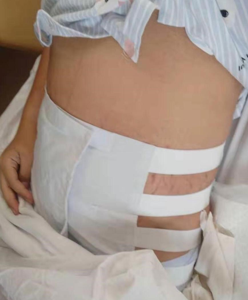 37周后胎儿基本不长终止妊娠,孕妇37周还不生怎么办