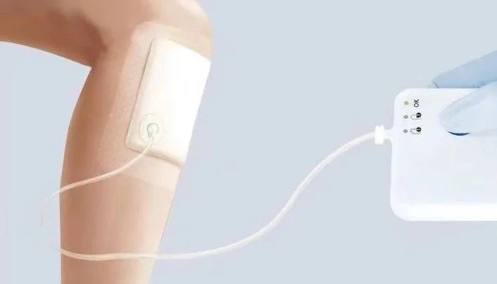 慢性创面患者的敷料运用及选择,创面换药敷料的选择