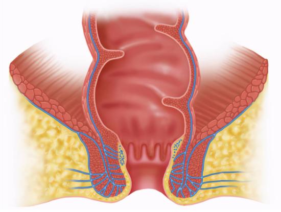 出门后回家应该怎么消毒,菊花的卫生怎么注意