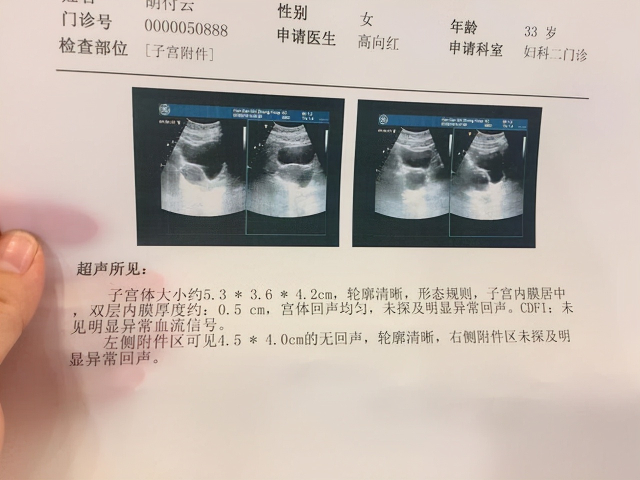 发现囊肿需要注意什么,医生提醒大多数囊肿无需处理