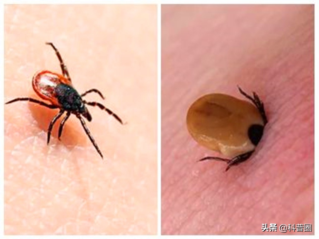致命蜱虫,比蜱虫还可怕