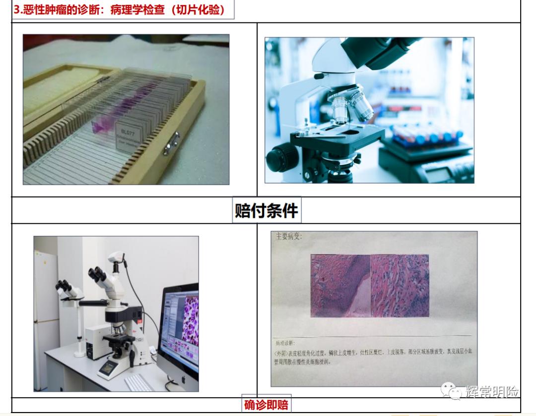 甲状腺恶性肿瘤相互宝能理赔吗,平安康寿宝恶性肿瘤疾病保险理赔
