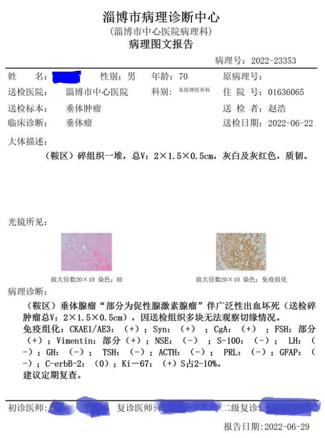 抢救失去的光明——市中心医院神经外科急症切除脑垂体瘤卒中一例