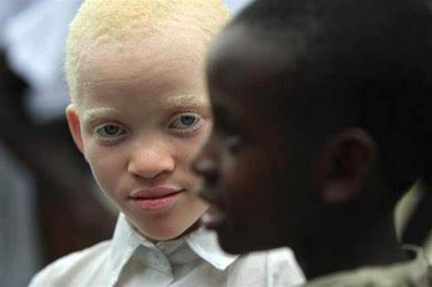 非洲版“唐僧”：血液堪比黄金遗骸可卖上百万，警方束手无策