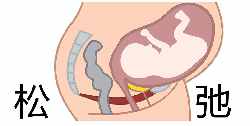 「掌健识」告别产后漏尿的正确方式
