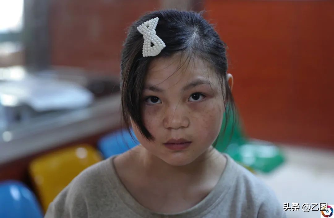 七岁女孩头上长疮怎么回事,女儿7岁身上长疮是什么原因