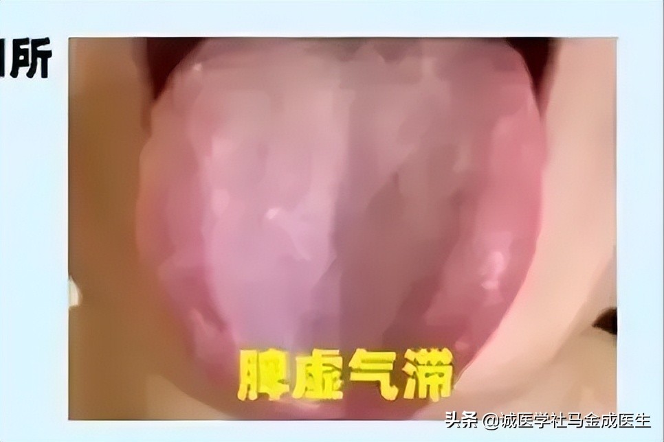 5岁小孩脾胃差吃什么中成药调理,脾胃肝肾肺亏损全部调理的中成药