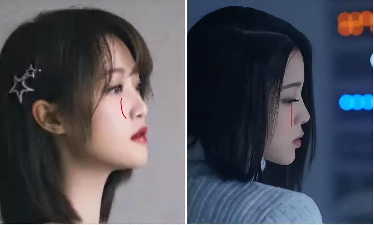 为什么大部分亚洲人都是扁头,正脸好看但侧脸丑到爆怎样办