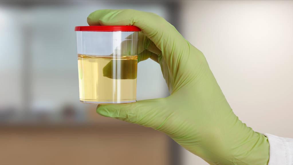 小伙查出尿毒症痛哭,男子查出肾衰竭