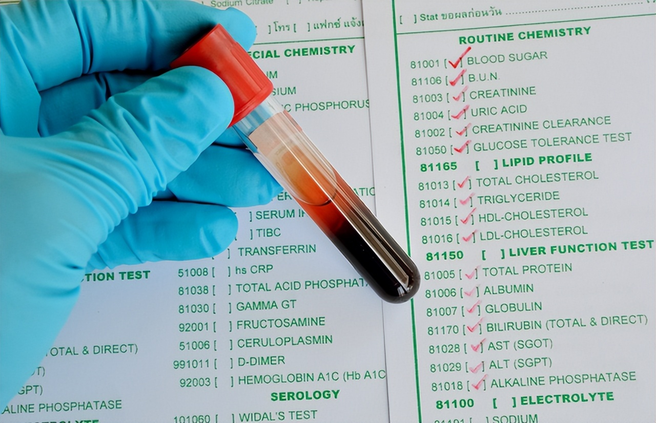 体检报告单中“转氨酶”偏高，意味着什么？医生揭晓真相