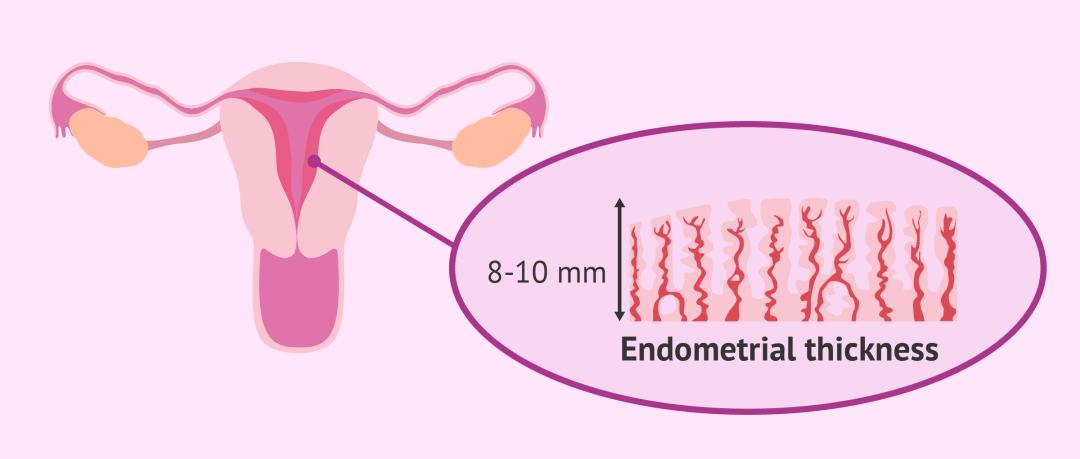 子宫内膜-成功妊娠的秘密*器武**