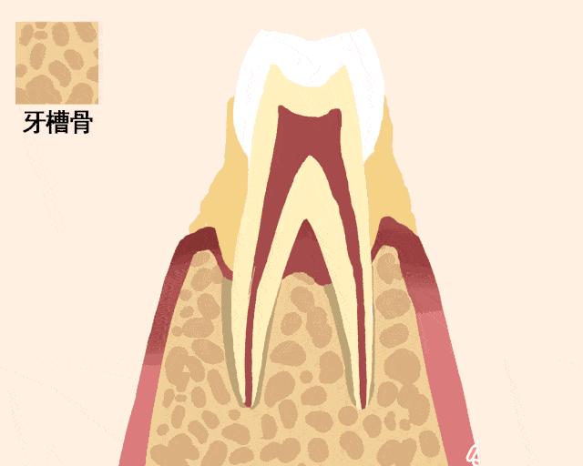 牙科牙齿松动怎么处理好,专家讲解牙齿松动疼痛吃什么药