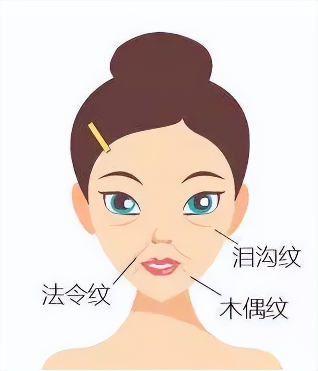 在九院祛法令纹,九院韦敏鼻基底填充与法令纹填充