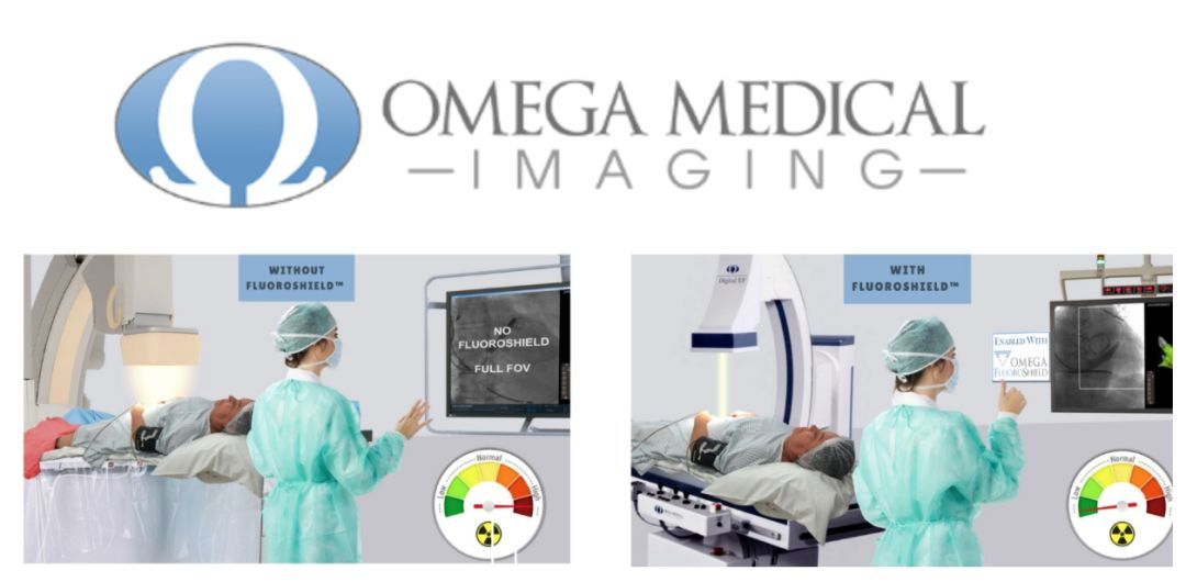 消融机器人,消融导管