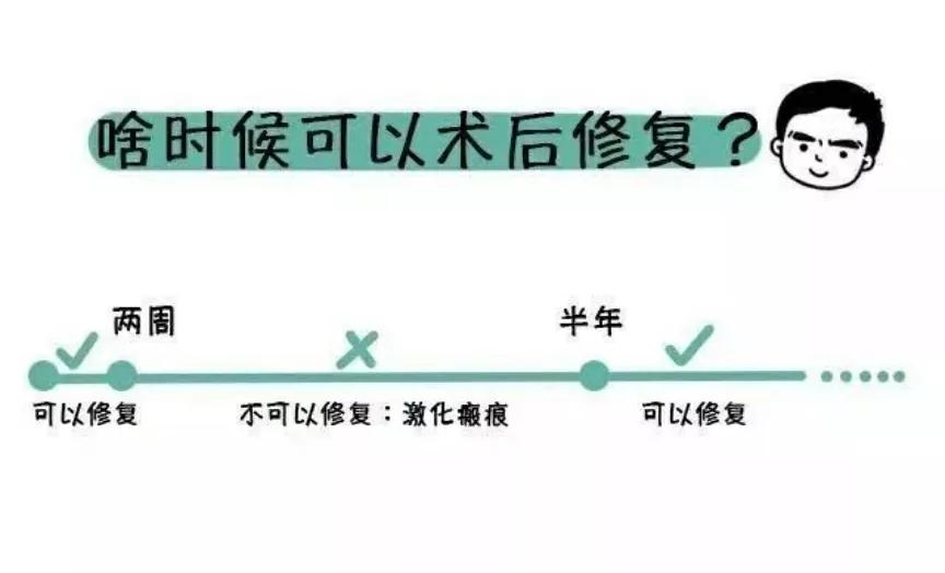 现在双眼皮修复都是什么手法,双眼皮修复怎么样才最好看