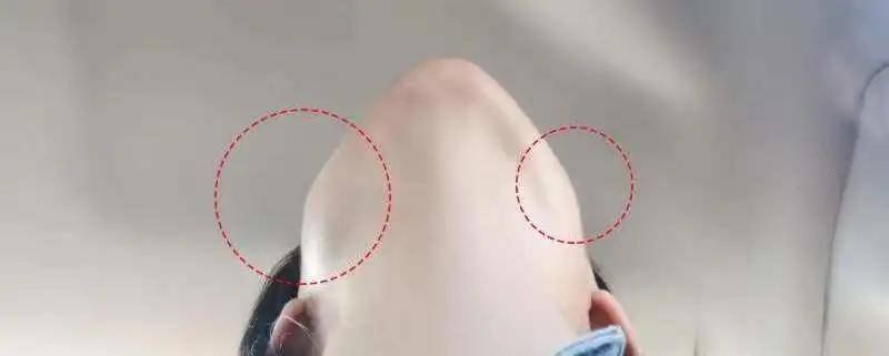 国民初恋毁容了,国民初恋盛世美颜