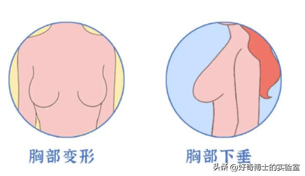 胸大运动怎么防震动,女生运动时胸部跳跃怎么办