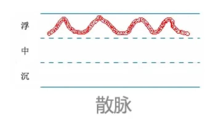 中医28脉诊歌诀及示意图,中医28脉全部脉象图解