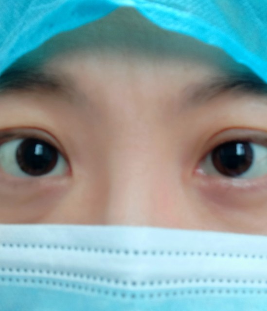 女人出现黑眼圈的原因,出现黑眼圈是怎么回事