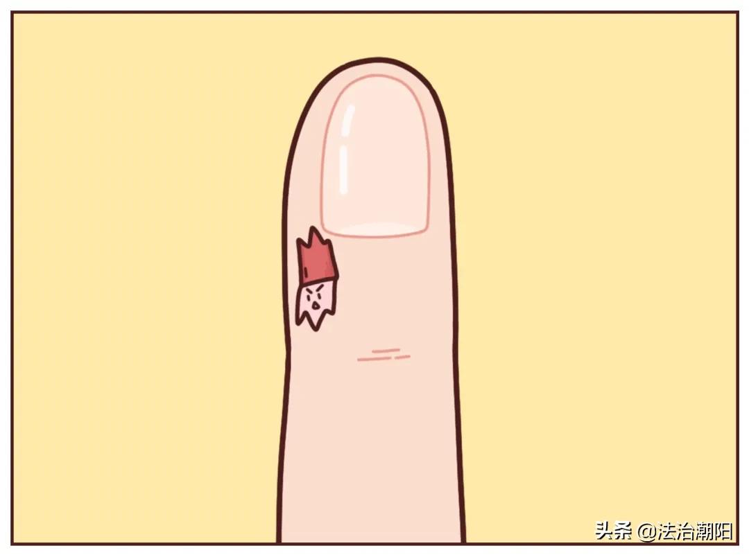 手指长倒刺缺乏哪种维生素,宝宝手指倒刺是缺什么维生素