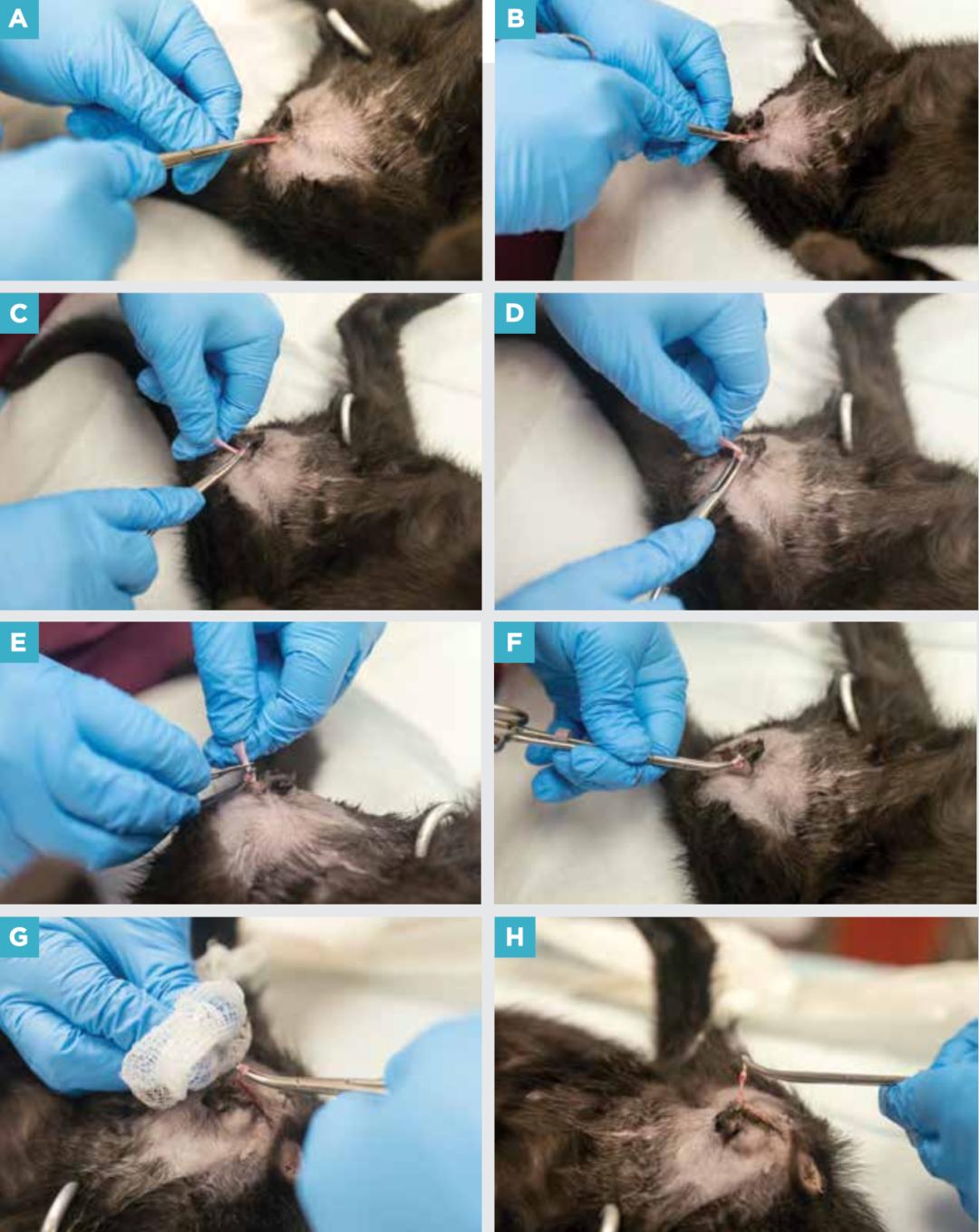 附睾炎切除术多少钱,附睾炎微创手术治疗全过程