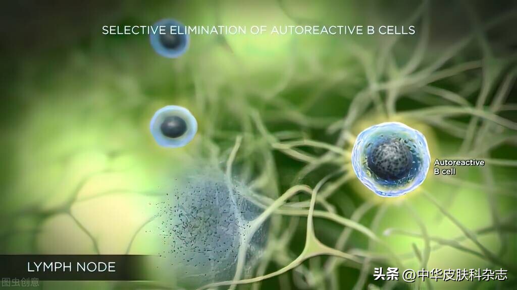 皮肤淋巴瘤遗传吗,皮肤t细胞淋巴瘤