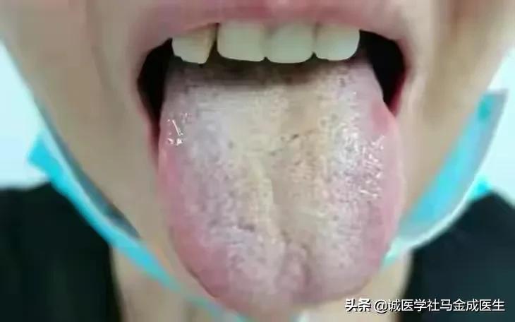 吃六味地黄丸上火？什么人不适合吃六味地黄丸？怎么吃不上火呢？