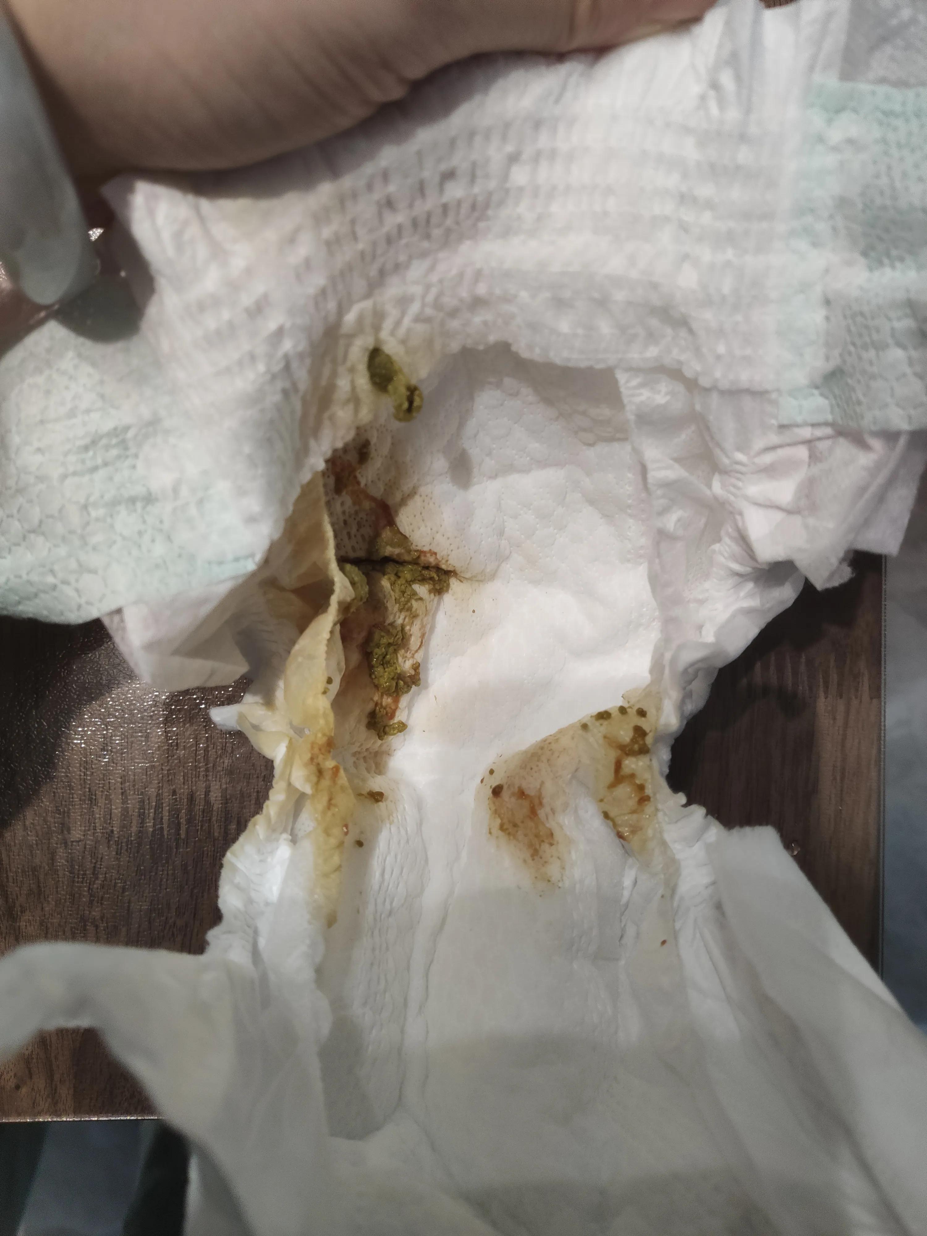 婴儿牛奶蛋白过敏最快解决办法,婴儿蛋白过敏怎么转奶