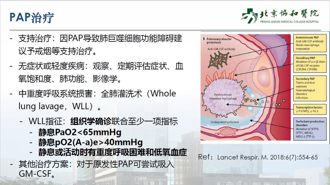 ecmo体外人工膜肺ppt,vv-ecmo怎么用