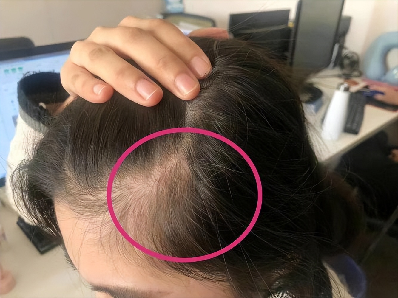 广州一女子坚持用硫磺皂水洗头,湖南校花坚持用硫磺皂洗头