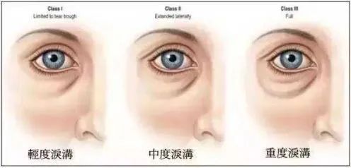 眼部护理的小秘密,眼部护肤应该涂哪些护肤品