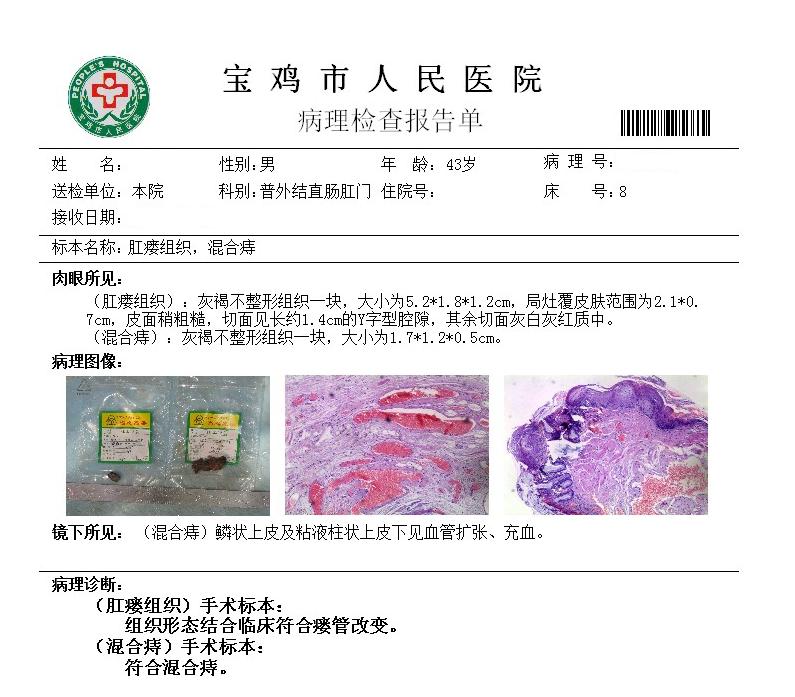 为什么有些人肛瘘一个星期就好了,为什么有的肛瘘术后不需要换药