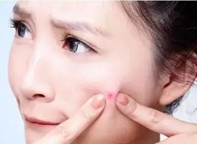 痘痘一直好不了变硬皮,痘痘一直好不了伤口溃烂