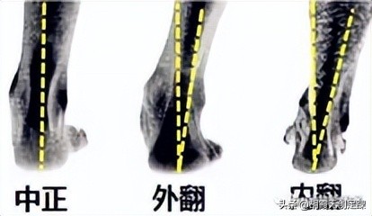 畸形脚穿什么品牌的鞋比较好,畸形脚定制鞋