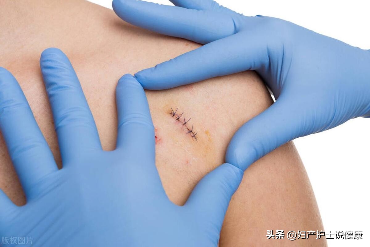 术后快速康复科普视频讲解,术后康复基础知识讲解