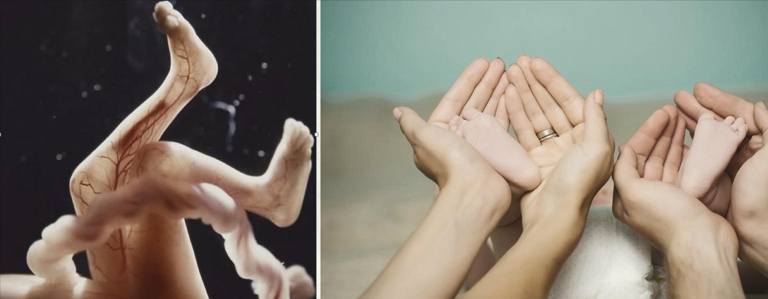 成人初期扁平足可以干预吗,两岁足外翻扁平足康复训练