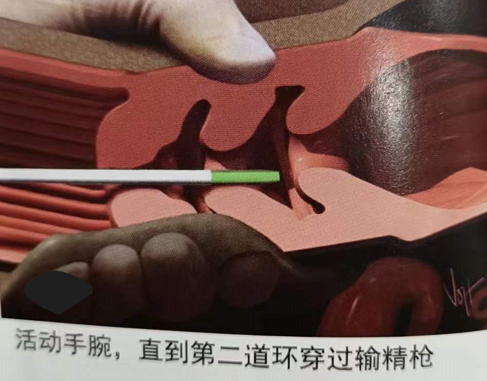 如何提高母牛同期的繁育能力,如何提高母牛受孕率