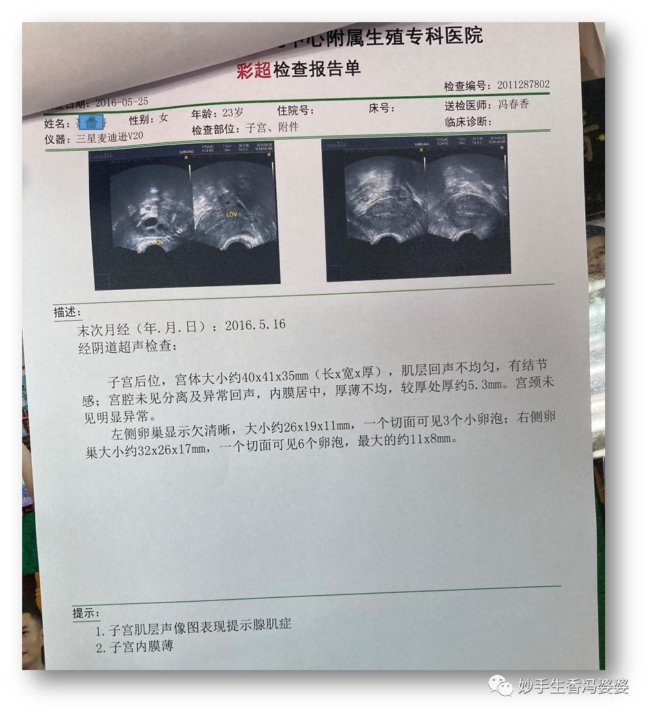 宫外孕后再怀孕容易胎停流产,宫外孕胎停怎么处理