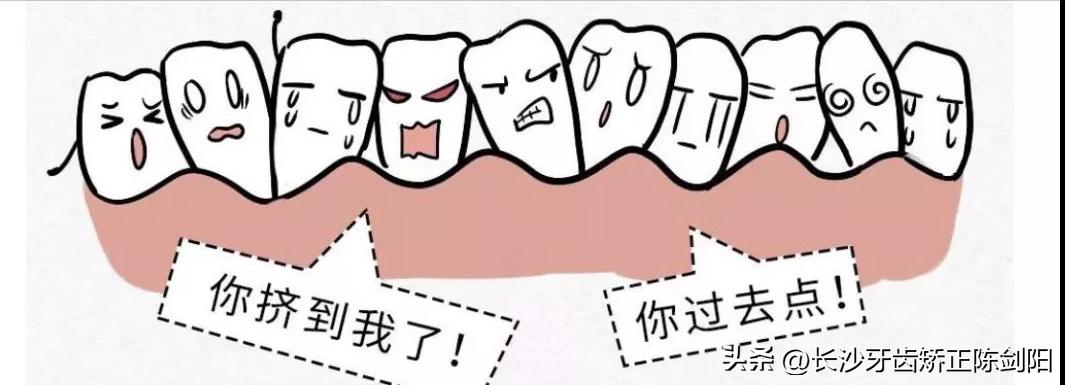 张嘴呼吸怎么自然改善,睡觉张嘴呼吸会变丑的图片