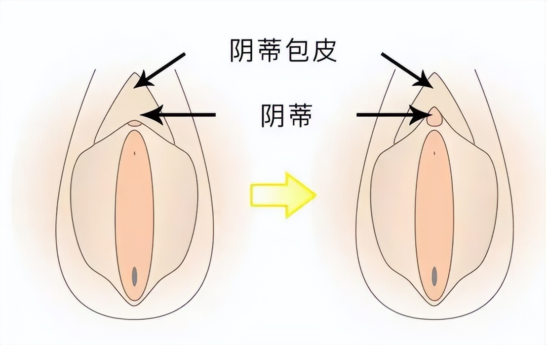 阴蒂痛的病因及对策