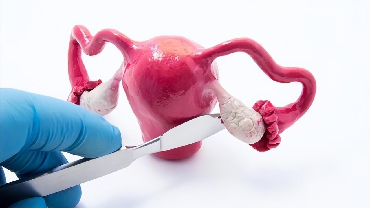 越来越多的女性得妇科肿瘤，医生研究发现：背后3个原因不容忽视