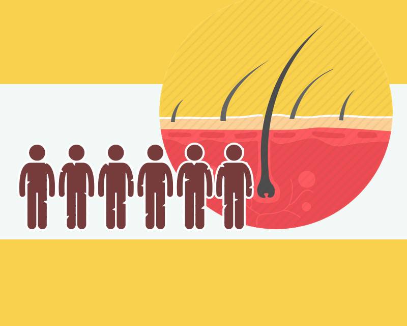 干发喷雾推荐去油蓬松,无味干发蓬松去油喷雾