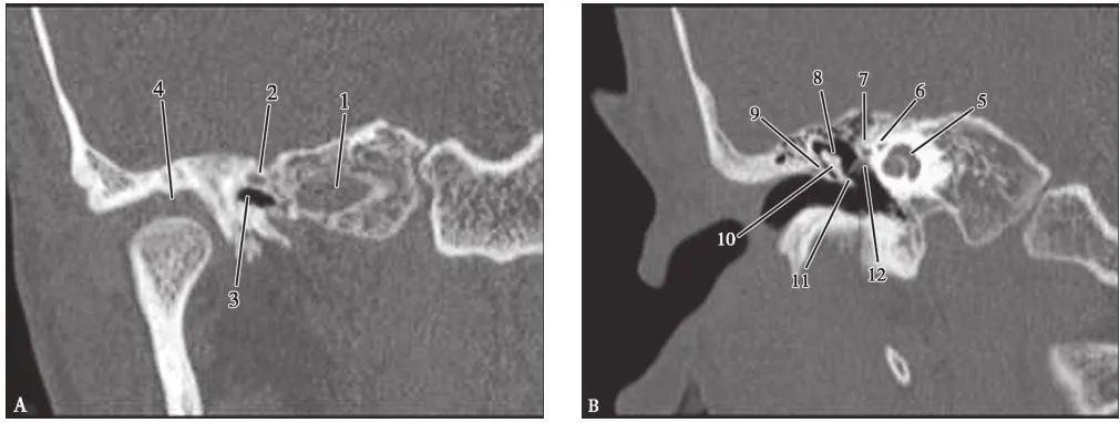 耳部解剖结构和生理功能,耳部解剖笔记