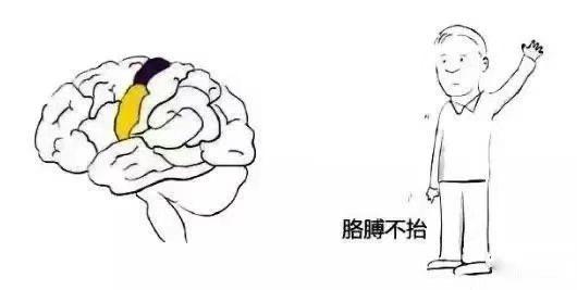 眼斜嘴歪的人怎么对付,嘴歪眼斜是不是中风的表现