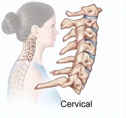 脊髓型颈椎病手术费用一览表,椎动脉型颈椎病手术风险多大