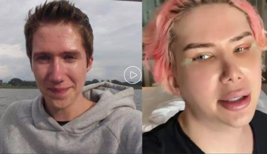 白人网红沉迷Kpop文化，狂整容还做丁丁缩小术，被韩国人骂至道歉